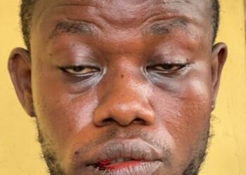 Journalist beaten by security personnel at Takoradi for allegedly photographing them